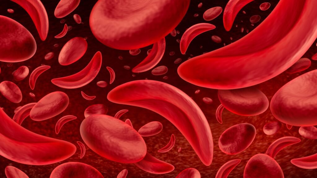 Daniel Cressy rings the bell after sickle cell gene therapy cure