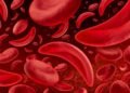 Daniel Cressy rings the bell after sickle cell gene therapy cure