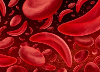 Daniel Cressy rings the bell after sickle cell gene therapy cure