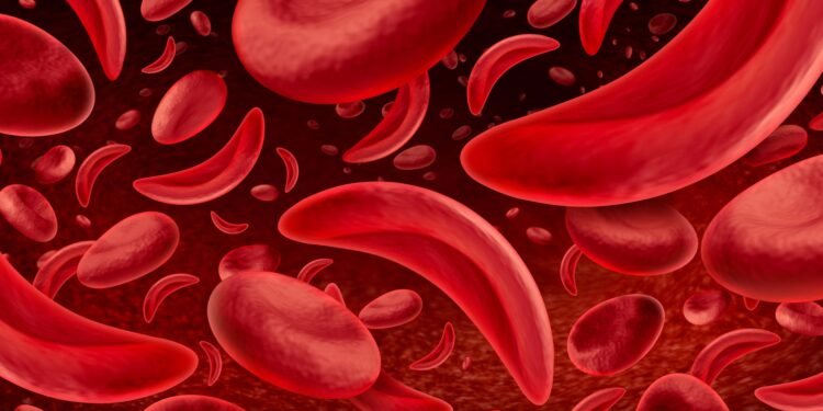 Daniel Cressy rings the bell after sickle cell gene therapy cure